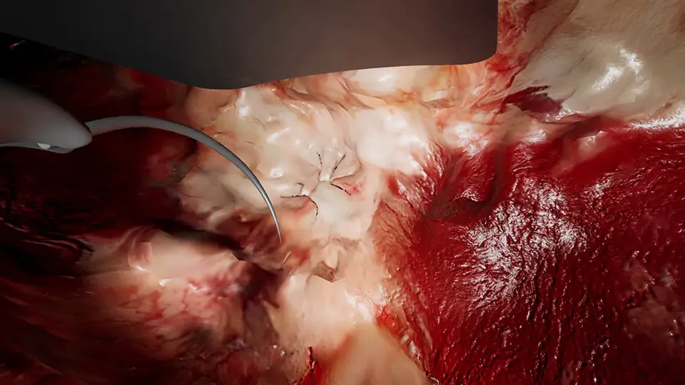 革新的な3D技術「SR3D」で、世界中の人々を幸せにするメタバースを創出