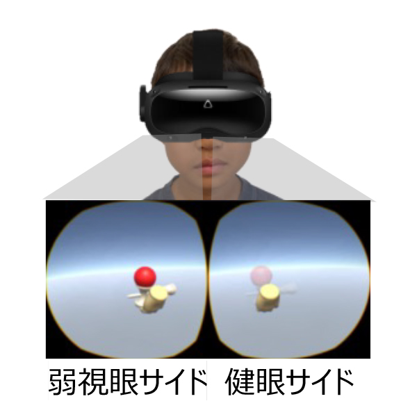 つらい弱視訓練を“楽しいVRゲーム”に――現役医師が開発する「処方される治療アプリ」
