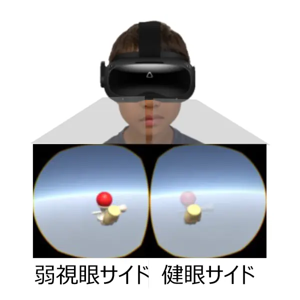 つらい弱視訓練を“楽しいVRゲーム”に――現役医師が開発する「処方される治療アプリ」