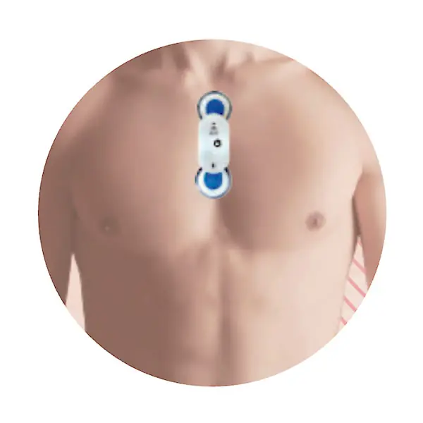 心房細動の「見逃し」をなくしたい——現役医師が挑む、不安を安心へ変えるAIモニタリングシステム