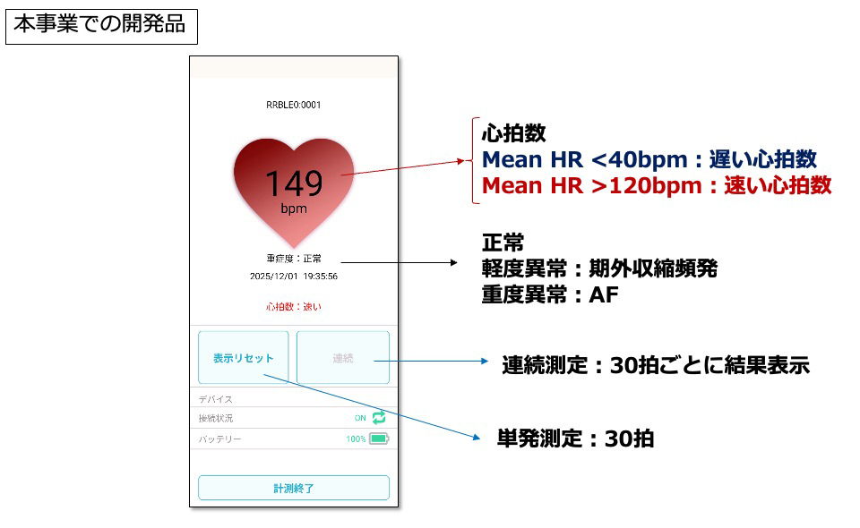 心房細動アブレーション治療後再発検出AIシステム 不整脈重症度診断アプリ