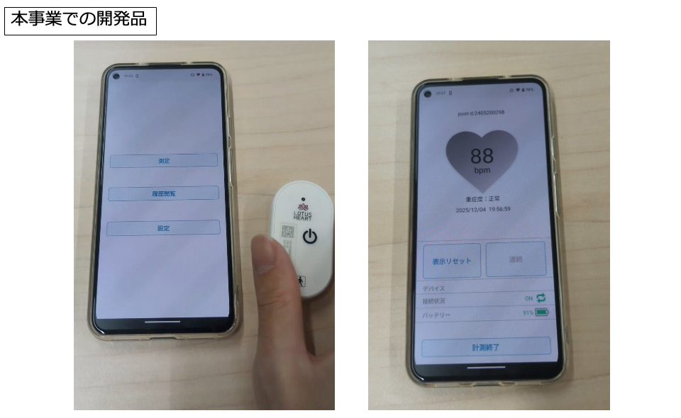 心房細動アブレーション治療後再発検出AIシステム 不整脈重症度診断アプリ