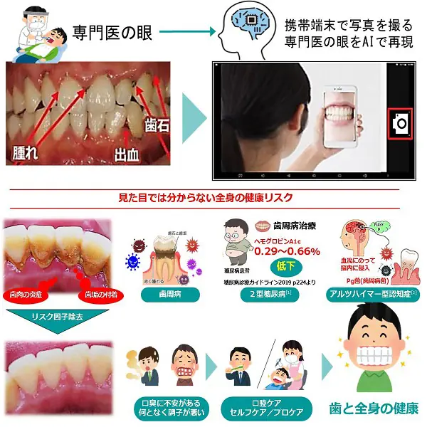 写真を撮るだけ、歯周病専門医の眼を再現するAI画像処理を用いた歯科領域のICT推進