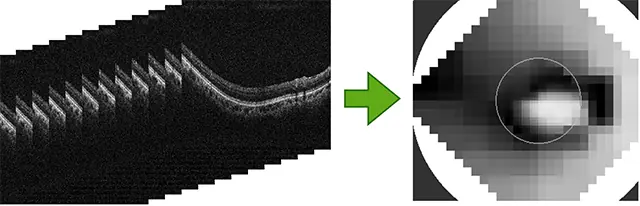  ～世界から「失明」という言葉を無くすために、眼科領域におけるAI医療機器プログラムSaMDを社会実装～