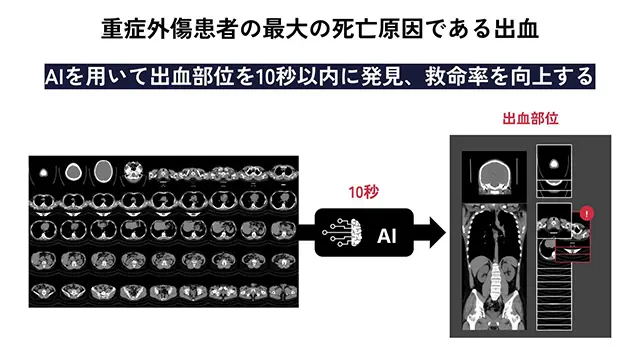 全身検索型画像診断AI技術を用いた外傷による致死的活動出血検出AIシステムの開発と実装